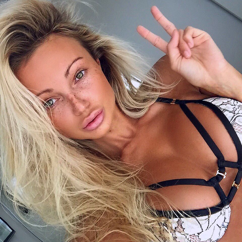 Denise Dowse актриса. Abby Dowse до операции. Anny Dowse.