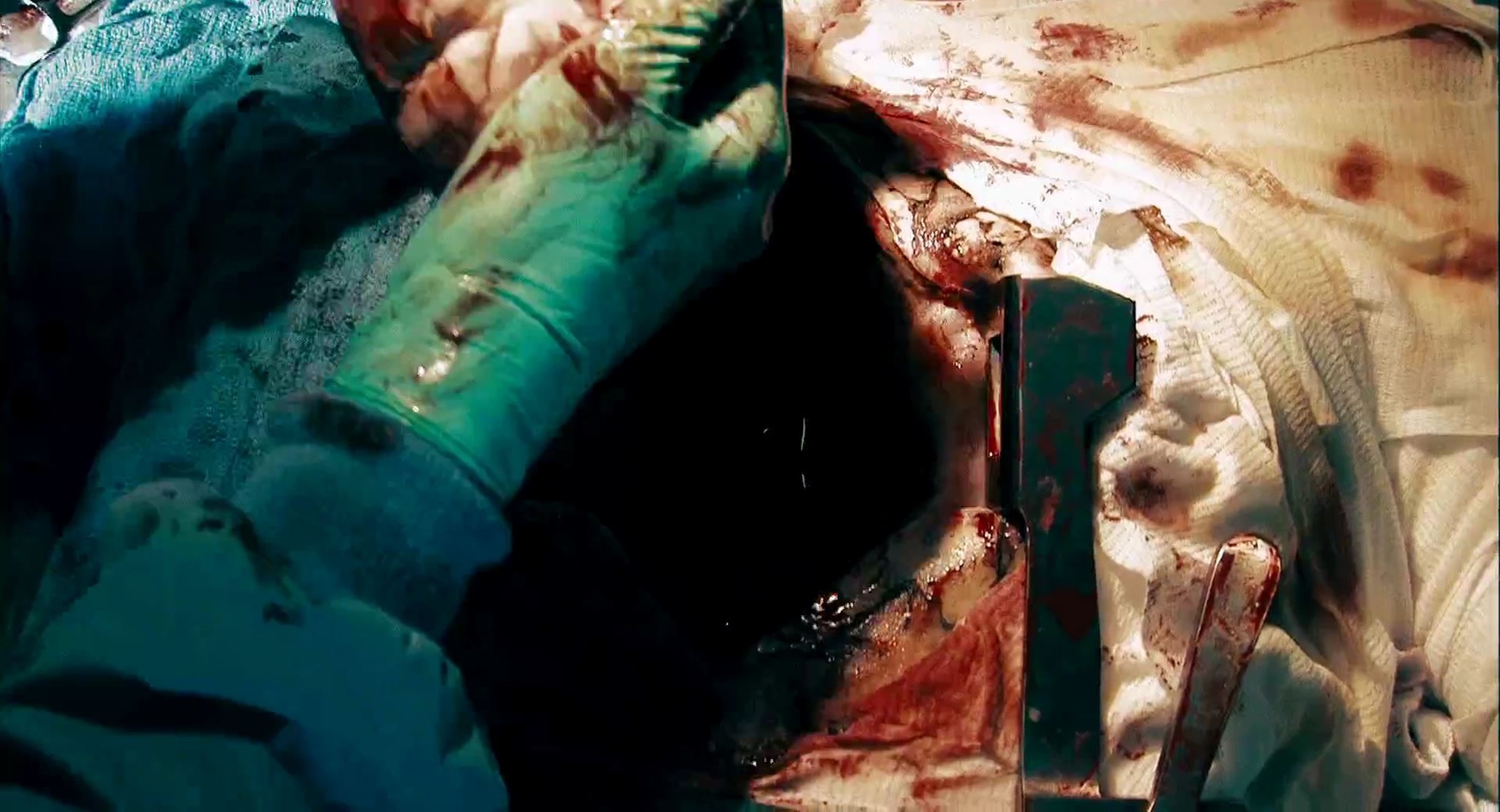 Crank 2: High Voltage