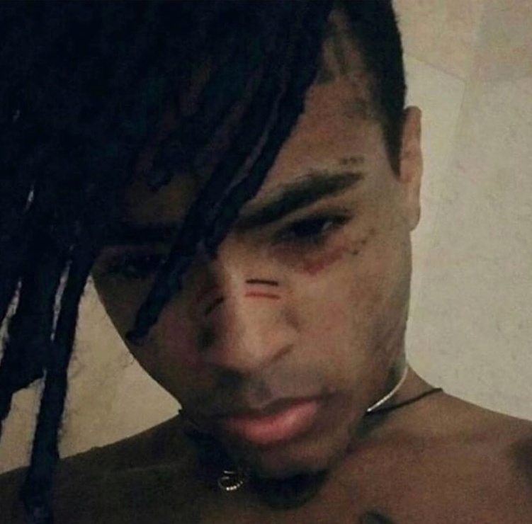 Picture of XXXTentacion