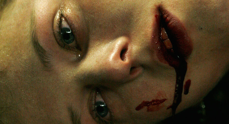 Scar