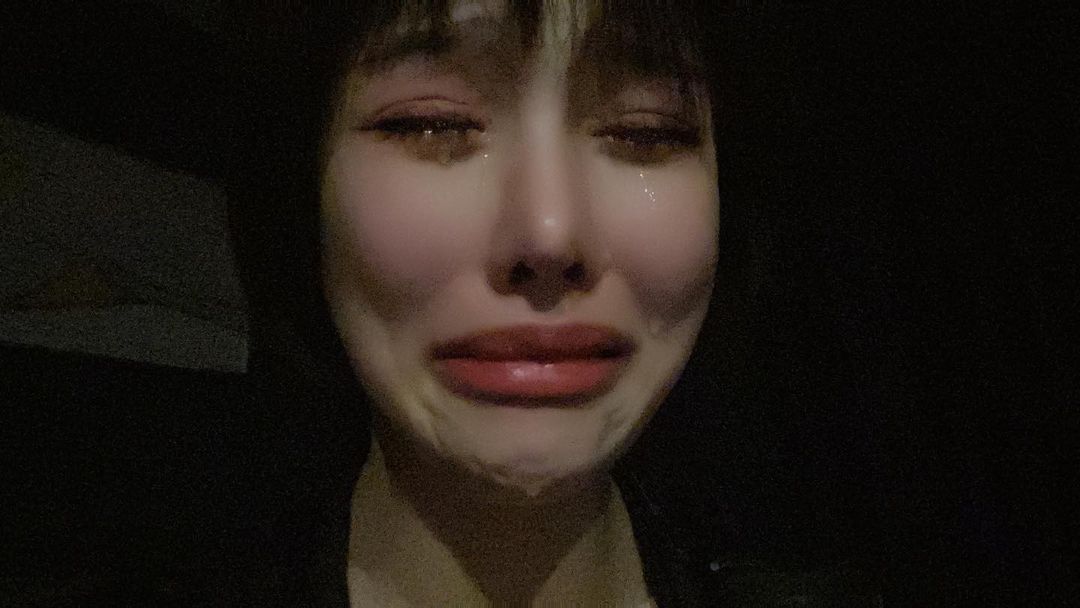 Songyuxin Hitomi