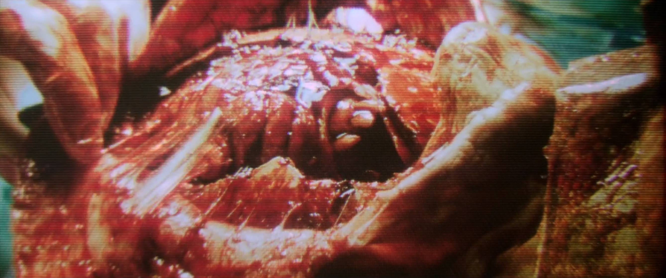 Malignant Malignant