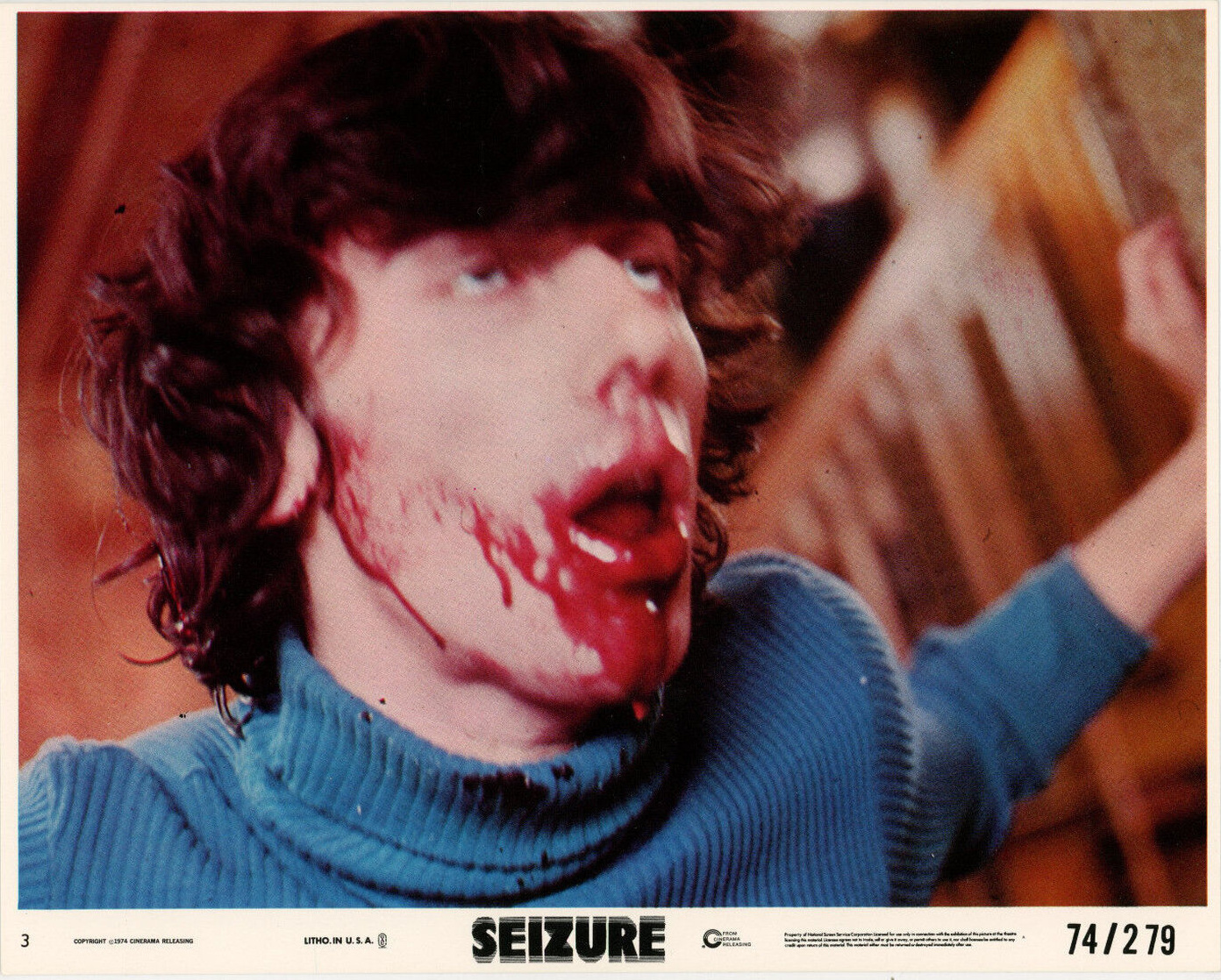 Seizure