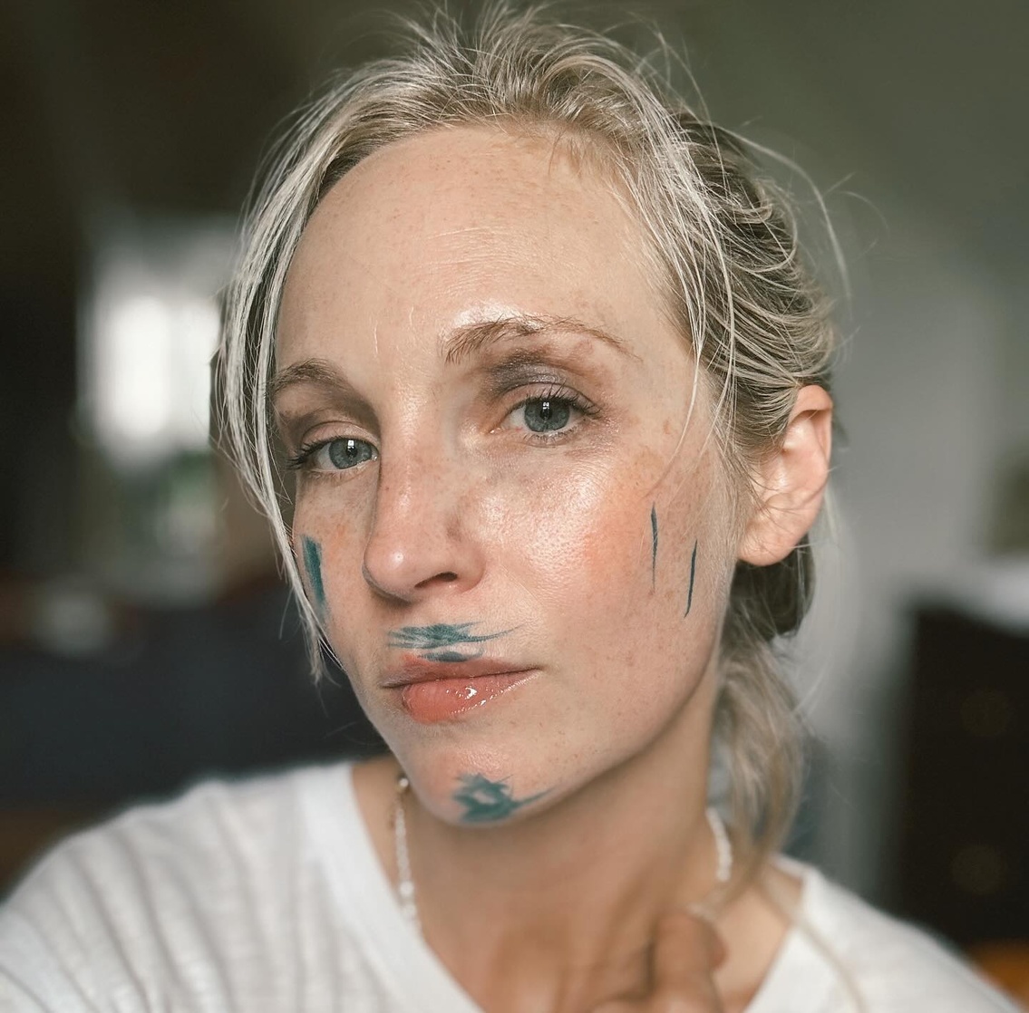 Candice Accola