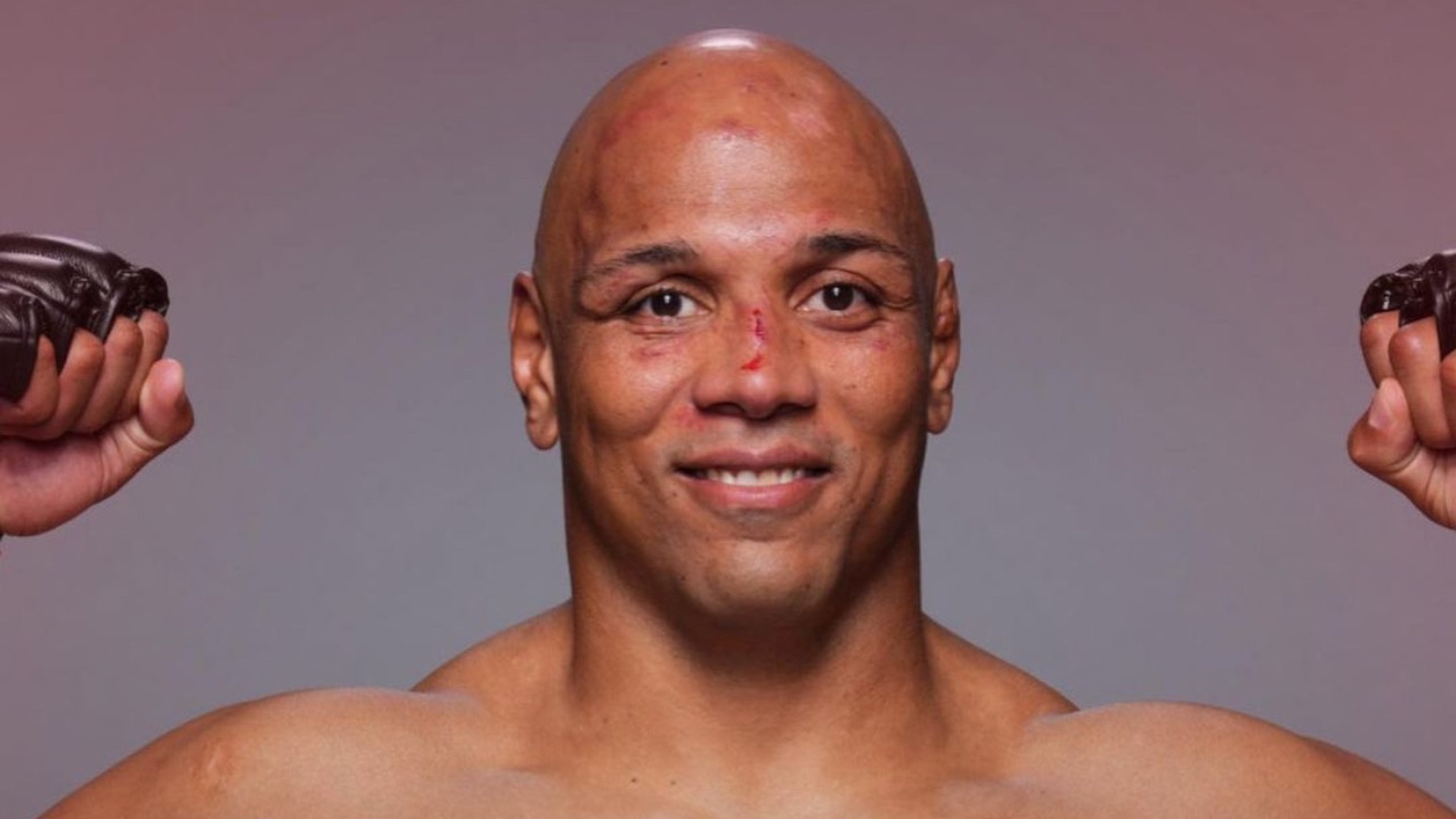 Marcos Rogerio De Lima