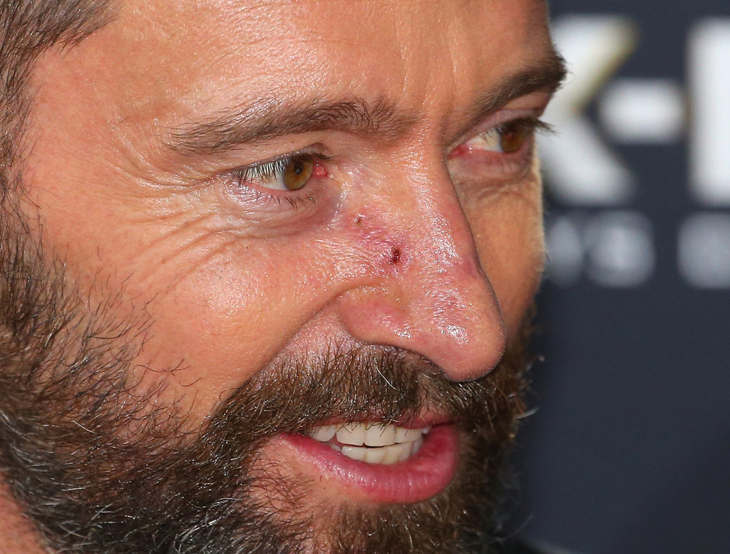Hugh Jackman