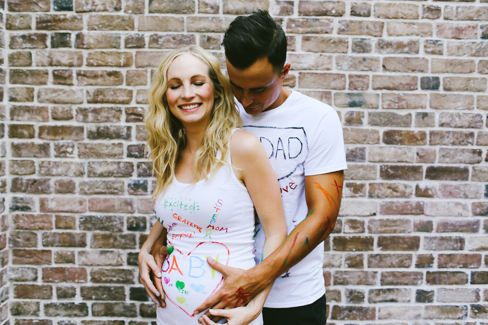 Candice Accola
